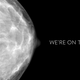 Illustration for article titled What You Need to Know About the Groundbreaking New Breast Cancer Study